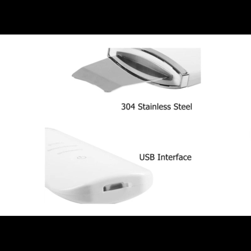 Ultrasonik Yüz Temizleme Cihazı 2