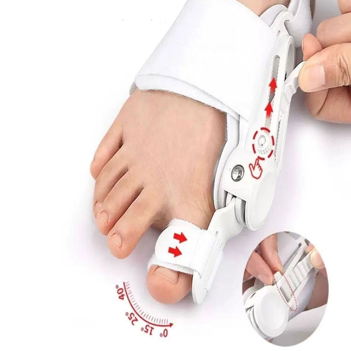 Ayarlanabilir Ayak Baş Parmak Kemik Düzeltici – Halluks Valgus (Bunyon) Aparatı, Gece Gündüz Kullanıma Uygun Ayak Düzeltme Ateli (5538) 1