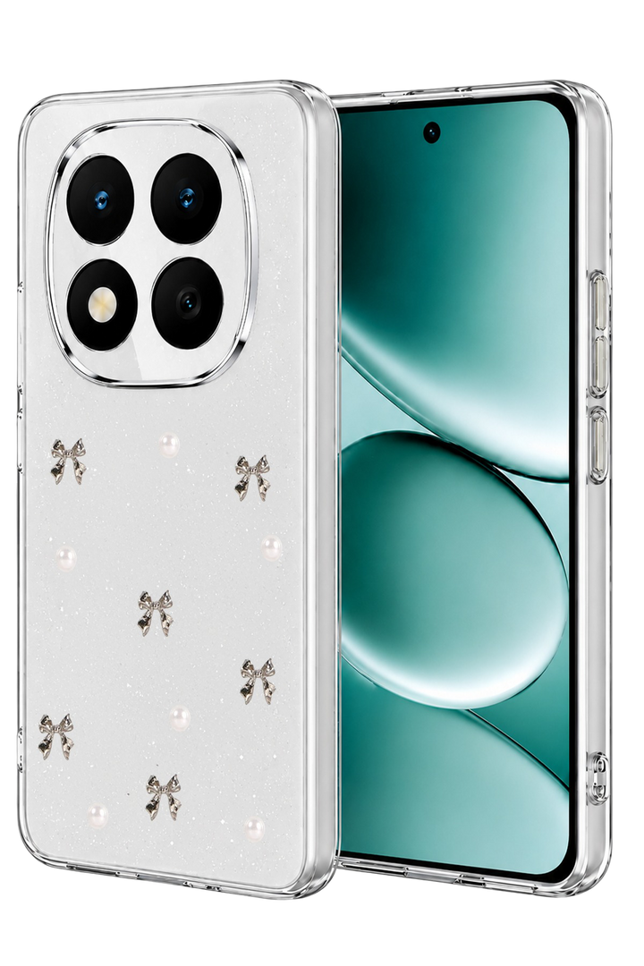 nebaktın Xiaomi Redmi Note 15 Pro 5G Fiyonk Desenli Kapak - Desen 8 1
